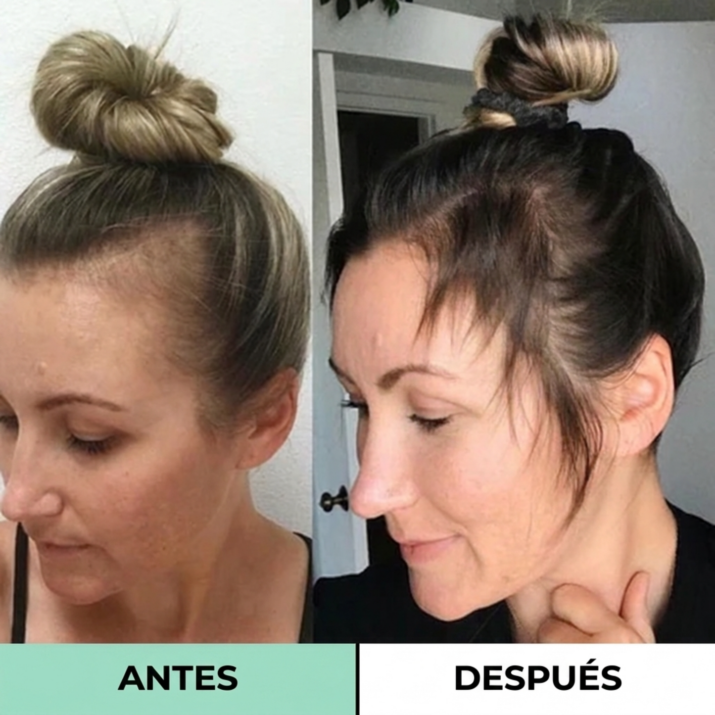 Misohair - Revitalizador Capilar Coreano