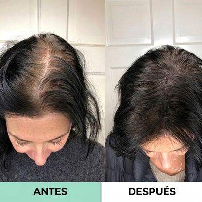 Misohair - Revitalizador Capilar Coreano